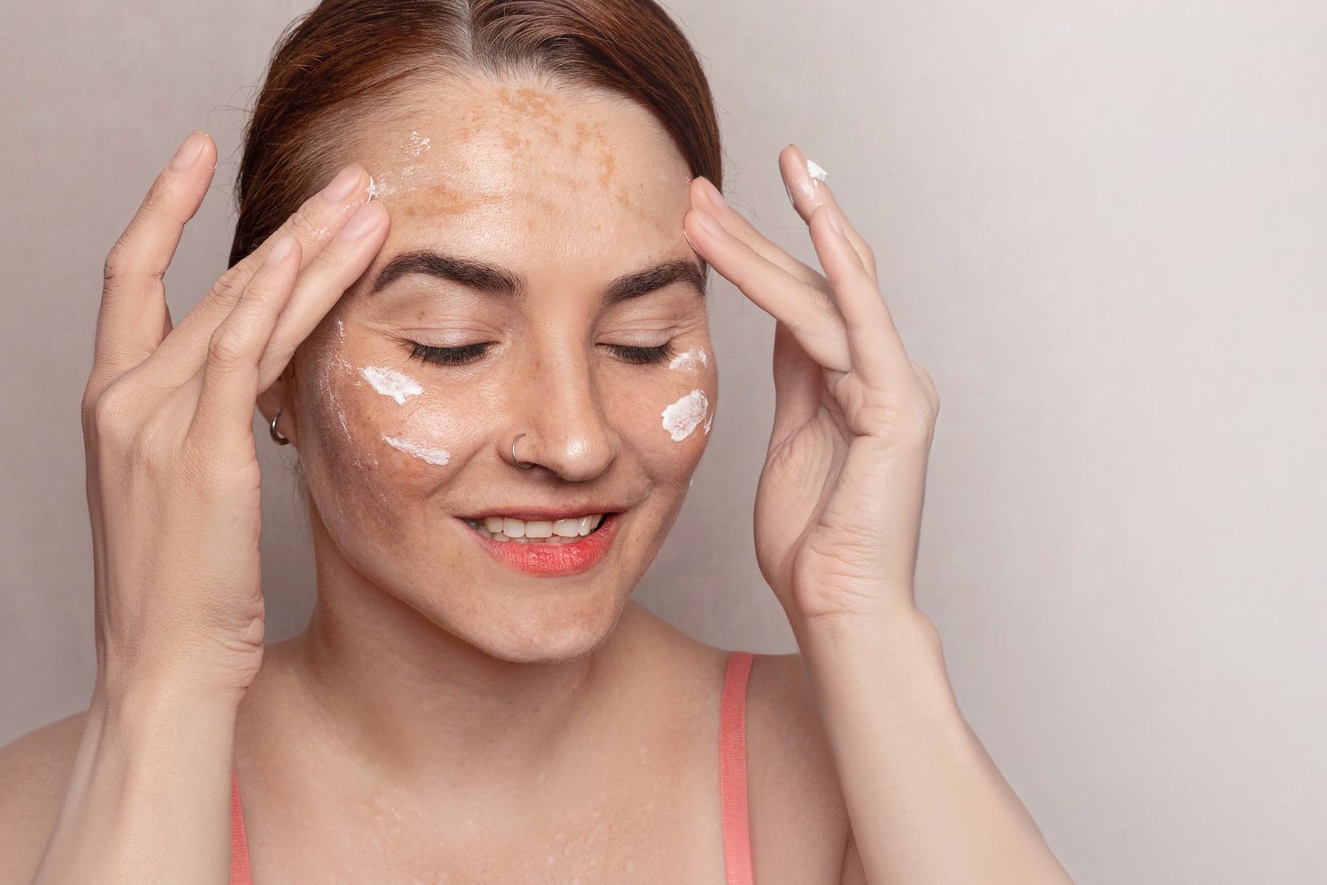 Eine Frau mit Melasma im Gesicht trägt Lächelnd eine Creme auf.